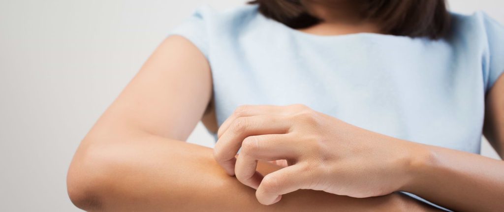 Natural Ways to Prevent Dry Skin 1 27167 6